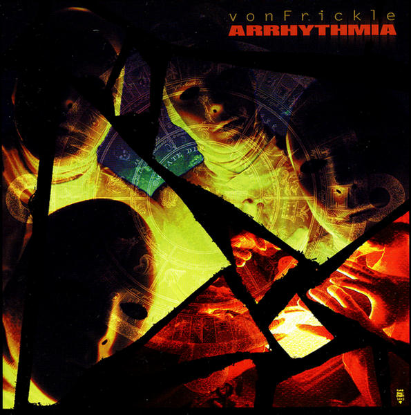 Arrhythmia